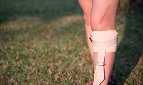 odbudowa nóg po operacji żylaków