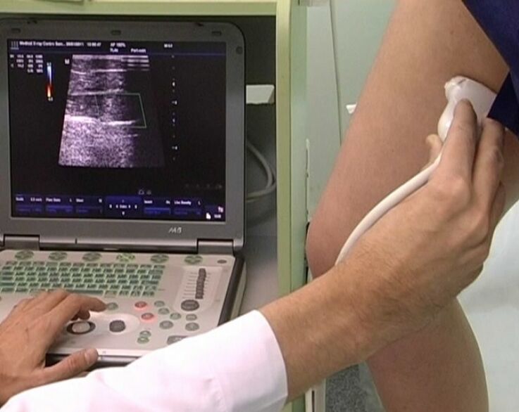 diagnostyka ultrasonograficzna żylaków miednicy