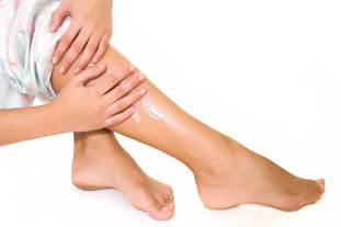 Objawy żylaków nóg u kobiet