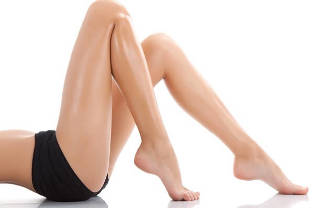 żylaki nóg u kobiet