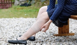 objawy żylaków nóg u kobiet